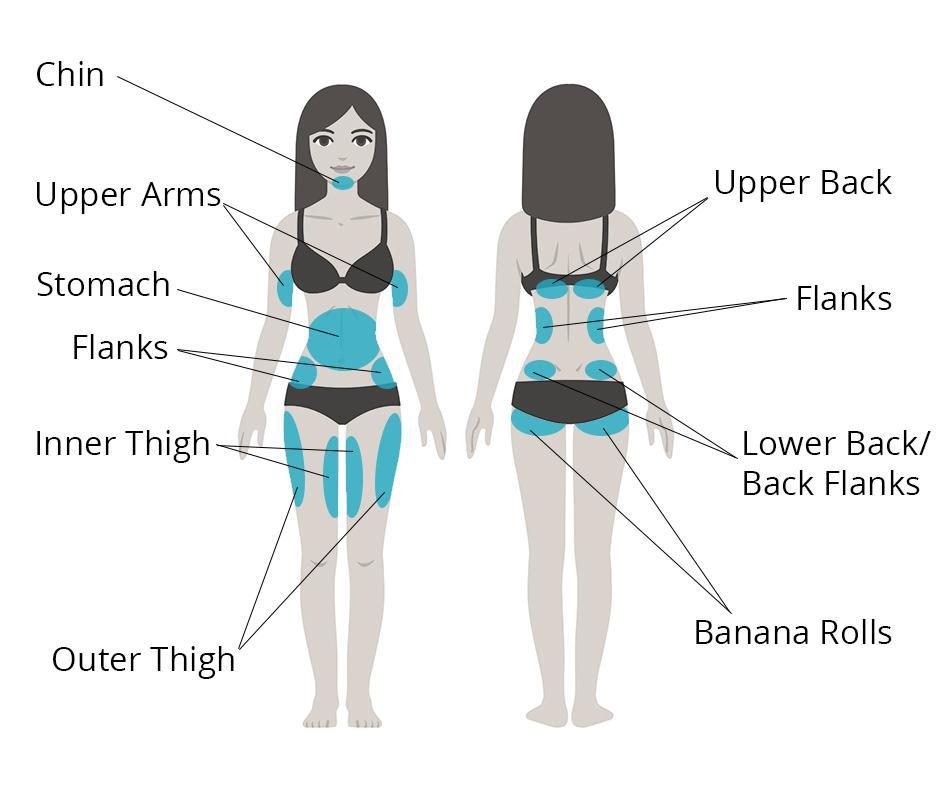common body problem areas