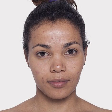 Bianca Venter