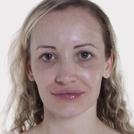 Jacoline Kritzinger