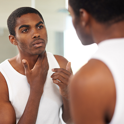 Melasma: It's true – men can suffer from it too