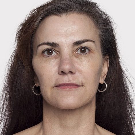 Daleen van Pletzen