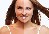 Solutions for sun damaged skin