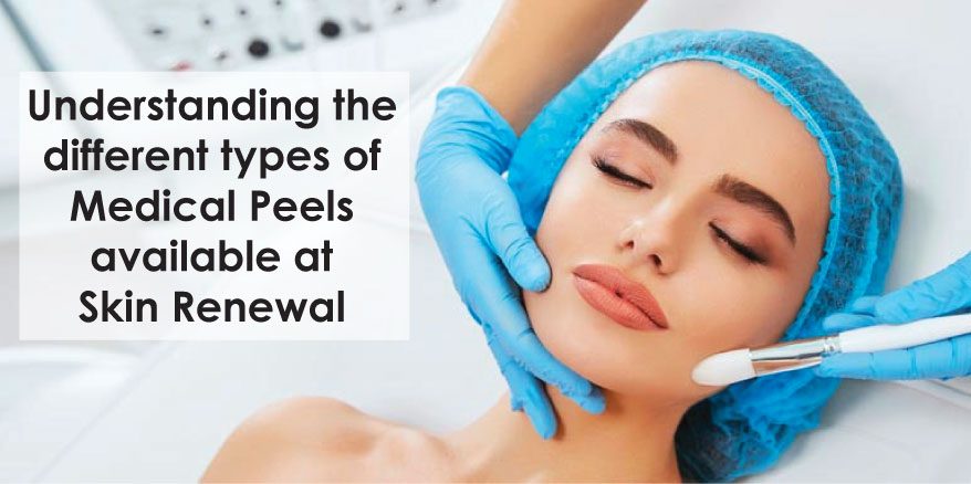 Different types of chemical peels