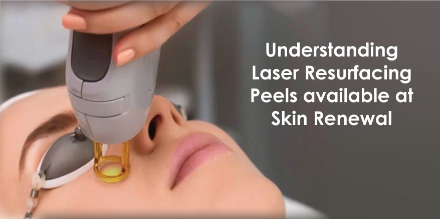 Different types of laser peels