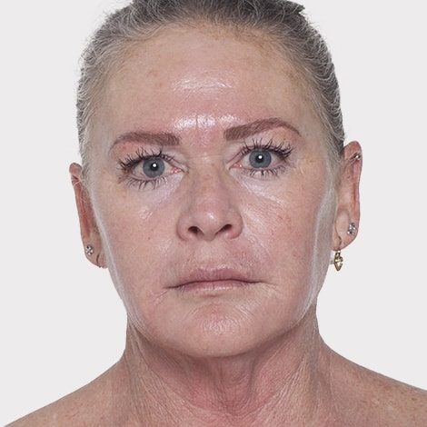 Patricia Viviers