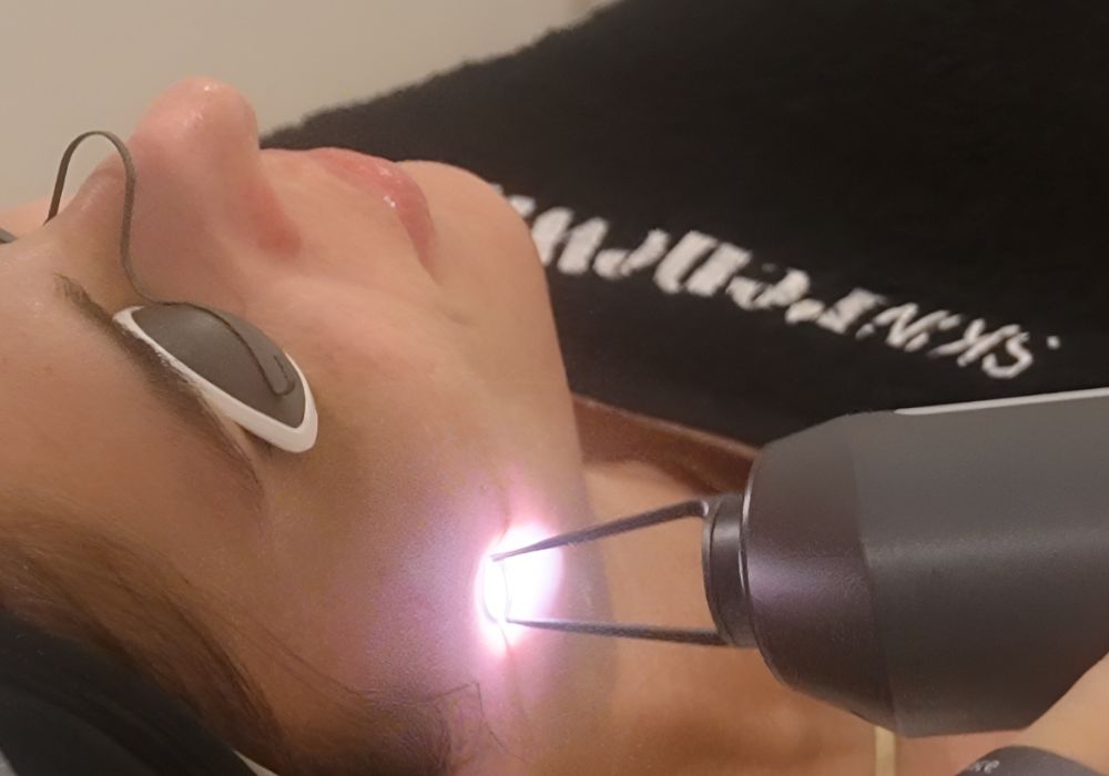 Treatments