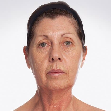Mooimaak | Behind the Scenes | Skin Renewal | Kyknet