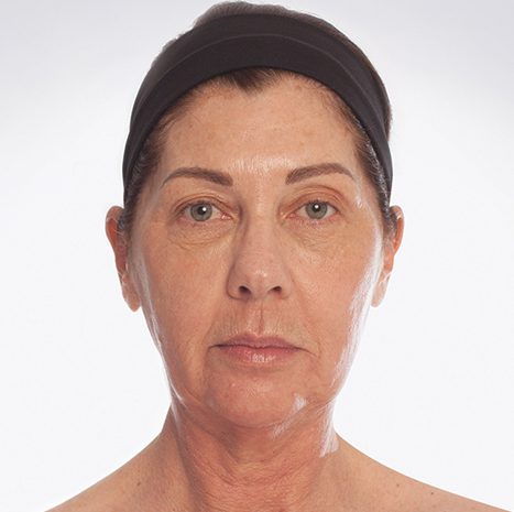 Mooimaak | Behind the Scenes | Skin Renewal | Kyknet