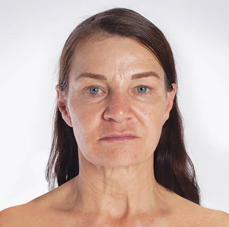 Mooimaak | Behind the Scenes | Skin Renewal | Kyknet
