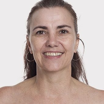 Mooimaak | Behind the Scenes | Skin Renewal | Kyknet