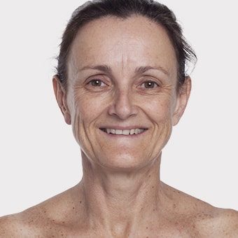 Mooimaak | Behind the Scenes | Skin Renewal | Kyknet