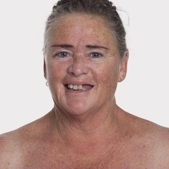 Mooimaak | Behind the Scenes | Skin Renewal | Kyknet