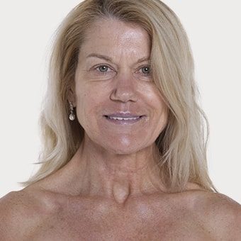 Mooimaak | Behind the Scenes | Skin Renewal | Kyknet