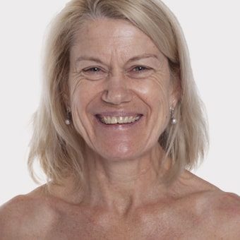 Mooimaak | Behind the Scenes | Skin Renewal | Kyknet